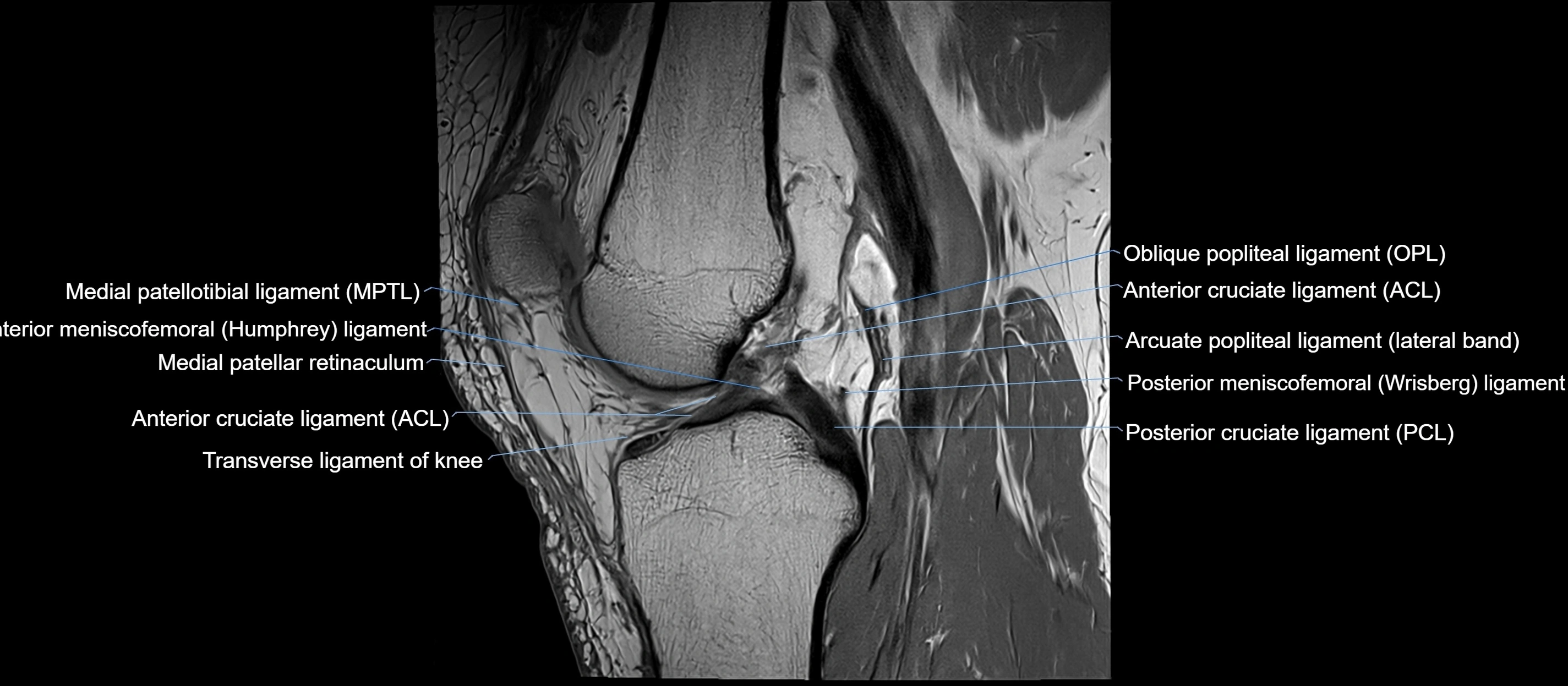 MRI sagittal  ligaments cross sectional anatomy 3T  radiology  image-img-00001-00025.webp